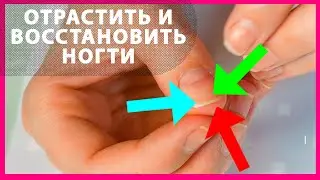 Как за неделю отрастить и восстановить ногти
