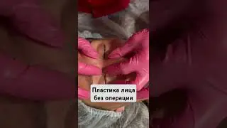 Как устранить нарушения на лице. #вмоскве #ринопластика #массаж #семья #пластиканоса #лаурасатумян