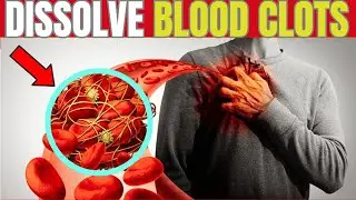 6 Everyday Foods That Naturally Dissolve Blood Clots | Hab Healthy