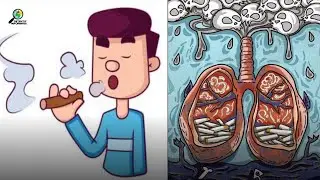 Inilah Penyebab Kalian Harus Berhenti Merokok Tonton Vidio ini Agar Kalian Cepat Berhenti