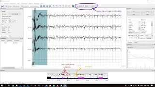 Automatic Sleep Scoring using Z3Score - NEO (8 minutes)