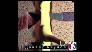 Как появляется межпозвоночная грыжа