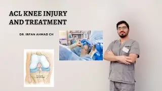 ACL Injury and Treatment