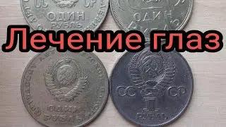 Лечение глаз народными методами.