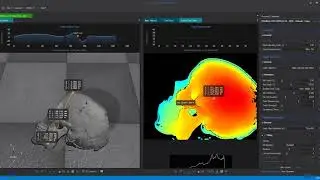 3D Skull with Crosssection Analyses