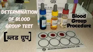Blood Group Test = Procedure Determination of Blood Group | ब्लड ग्रुप कैसे पता लगाते हैं 