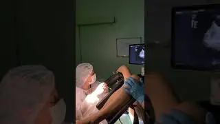 Перенос эмбриончика