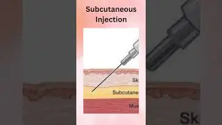 Types of injections