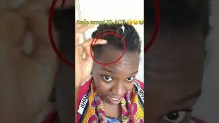 Scalp turned BLACK😳😖then I CUT ALL THE HAIR💇🏽‍♀️💔😭😞🤭