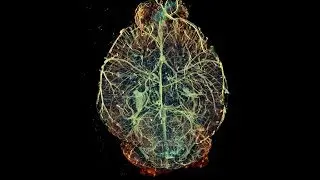 Imaging inside the body: Centre for Advanced Biomedical Imaging at Royal Soc Summer Exhibition 2014