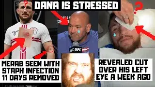 Merab Dvalishvili Has Staph Infection? Cut Over His Eye? Sean O'Malley By KO At UFC 306?