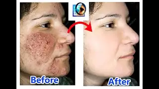 Clean your face in Photoshop 7.0 | Remove pimples, blemishes, acne easily tutorial.