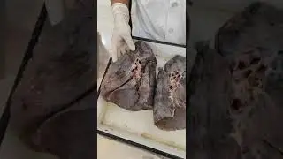Lung important impressions