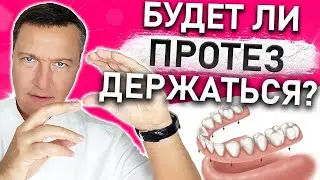 Как крепятся ПРОТЕЗЫ зубов? Как ФИКСИРОВАТЬ зубные протезы? Виды крепления съемных зубных протезов.