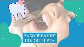 КАКИЕ ЕСТЬ ЗАБОЛЕВАНИЯ ПОЛОСТИ РТА?