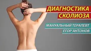 Как диагностировать сколиоз у детей и взрослых
