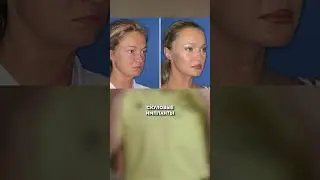 КАК скрывают внешность ПРЕСТУПНИКИ? БЕЗ ЛИЦА!Пластический хирург Андрей Искорнев. Искренне Ваш.
