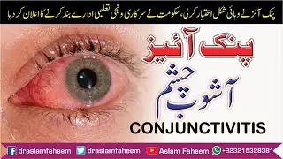 How to Get Rid Pink Eye | What is Conjunctivitis, Causes, Symptoms, Treatment  and Preventions