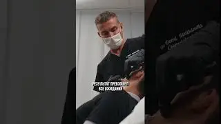Контурная пластика скул для пациента модели #инъекции #косметология