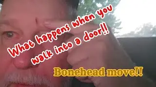 Busted Head #foryou #bonehead #hurt #blessed #god #godblessed #godsblessings #funny