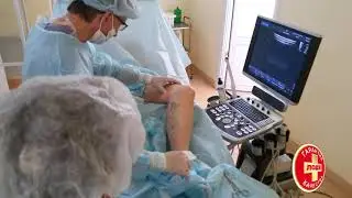 Лечение варикозной болезни методом склеротерапии