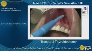 Transoral Thyroidectomy
