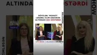 Zaurun verlişində döyülən memati ləqəbli alim danışdı