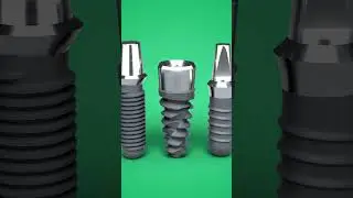 Dental Implant Visualization Works #3d #implant #dental #render #visualization