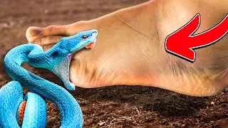 Una Serpiente GIGANTE Mordió mi PIE! ¡No se ve bien! 🤒