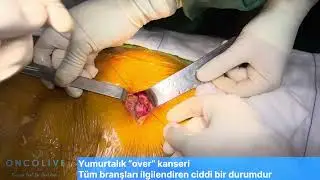 Yumurtalık “over” kanseri tüm branşları ilgilendiren ciddi bir durumdur.