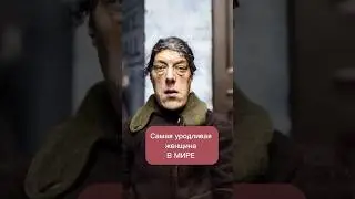 Сама уродливая  женщина в мире 