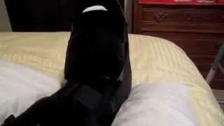 Bunion Surgery-Not For The Squeamish!