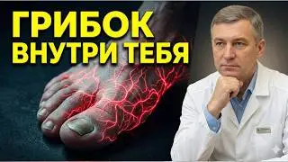 Грибок на ногтях — это последняя стадия. Первая — внутри