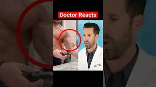 ER Doctor REACTS to World's Largest Veins