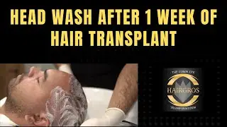 How to Wash Your Hair on The  After 1 Week of Hair Transplant Operation | Hairgros | Hairtransplant