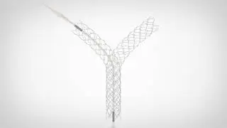 Niti-S LCD™ Biliary Stent