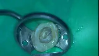 MAH01025