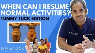 Popular Plastic Surgery Questions: Resuming Normal Activities After Tummy Tuck?
