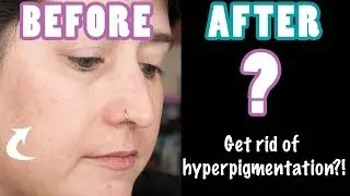 GET RID OF DARK SPOTS? 6 Week Test! Juice Beauty Age Defy Green Apple Kit | REVIEW IN 5