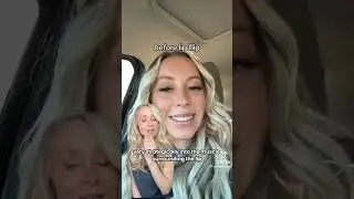 Before & After Lip Flip | Derm Weighs in #shorts