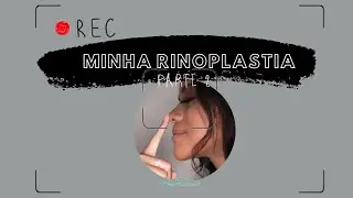 MINHA RINOPLASTIA - PARTE 2 | ATUALIZANDO SOBRE REAL RESULTADO