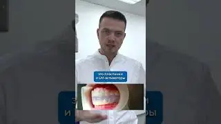 Топ 3: Как исправить прикус 