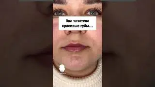 Она захотела красивые губы.