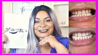 BLANQUEA TUS DIENTES EN 30 MINUTOS !!!!