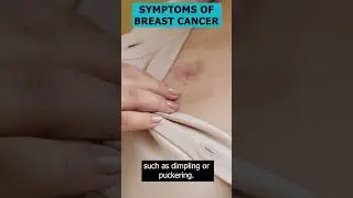 Breast Cancer Symptoms: A 30-Second Guide 🎗👀 