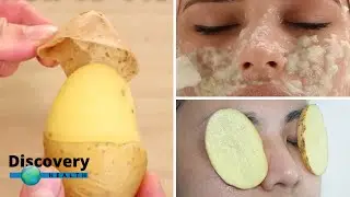 5 Surprising Uses For Potatoes that may Surprise you | Discovery Health