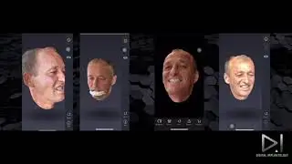 dr.Giampiero Ciabattoni Digital Implantology Video Channel