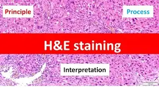 HE Staining: Principle, Procedure, and Interpretation | Haematoxylin and Eosin Staining |