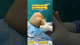 Never Do This Mistake in Ligament Tear🔥 लिगामेंट सर्जरी वाले ध्यान दें #ligamentinjury #ligamenttear