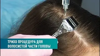 Мезопроцедура трихо. Для волосистой части головы